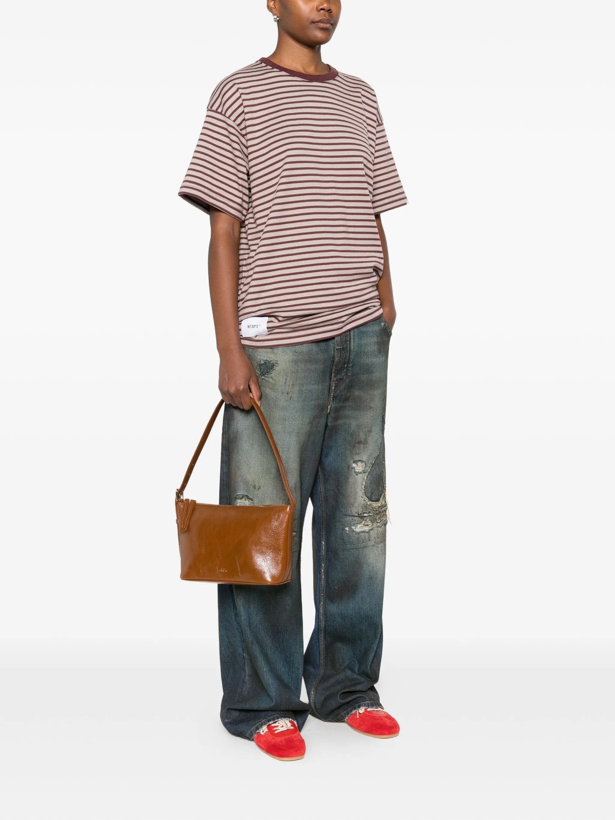 Sac vera shoulder