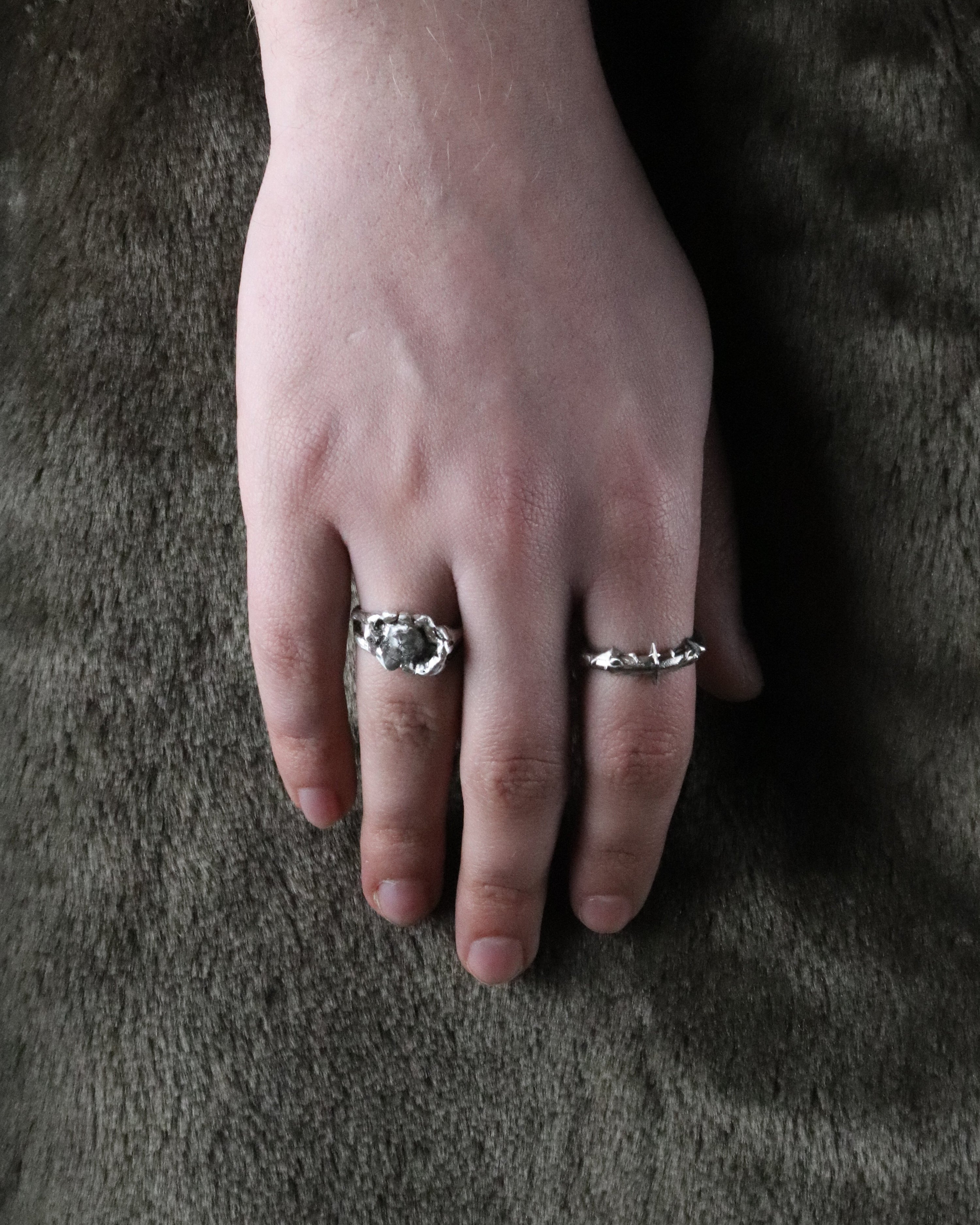 01-piece series femur ring