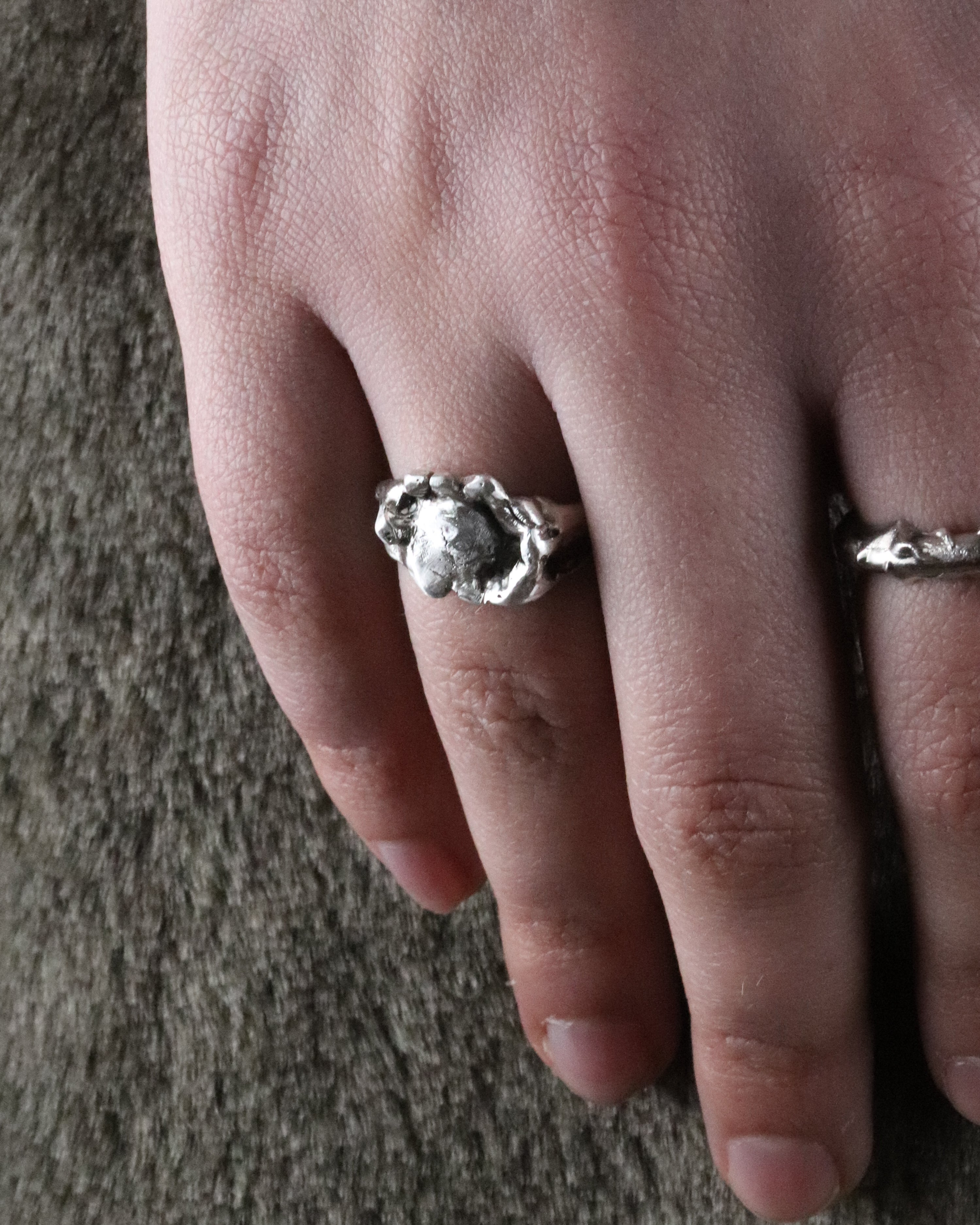 01-piece series femur ring