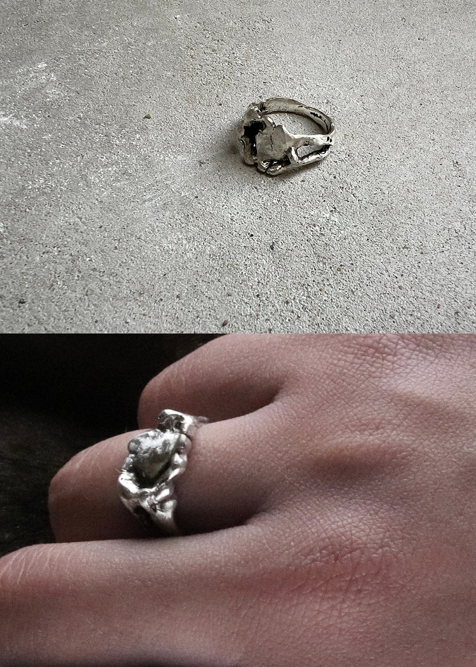 01-piece series femur ring